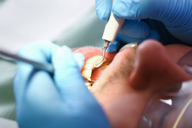 Best Mobile Emergency Dentist in Sylacauga, AL