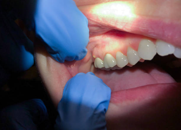 Best Pediatric Emergency Dentist in Sylacauga, AL